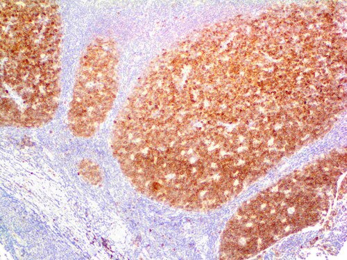 IHC of CD10 on an FFPE Tonsil Tissue